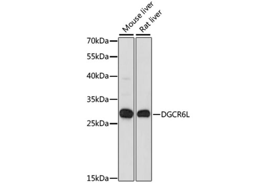 Western Blot - Anti-DGCR6L Antibody (A88907) - Antibodies.com