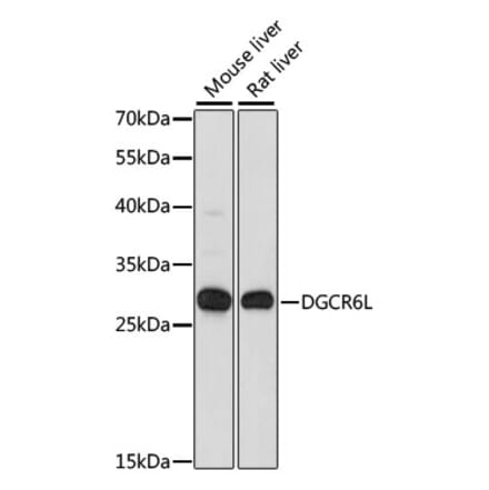 Western Blot - Anti-DGCR6L Antibody (A88907) - Antibodies.com