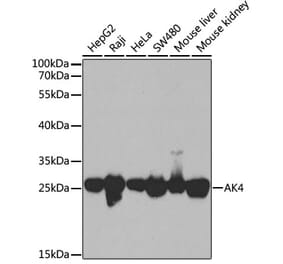 Western Blot - Anti-AK3L1 Antibody (A88908) - Antibodies.com