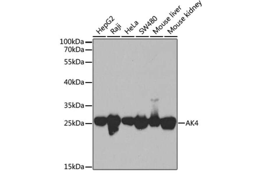 Western Blot - Anti-AK3L1 Antibody (A88908) - Antibodies.com