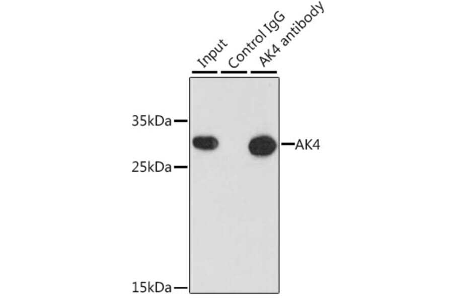 Immunoprecipitation - Anti-AK3L1 Antibody (A88908) - Antibodies.com