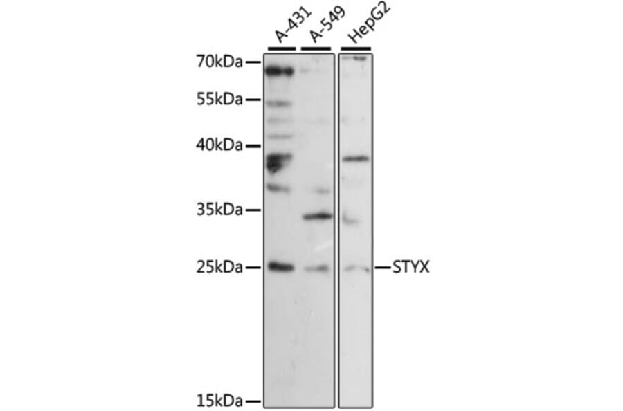 Western Blot - Anti-STYX Antibody (A88909) - Antibodies.com