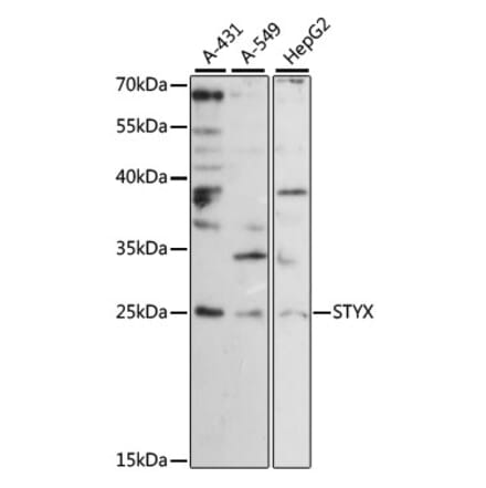 Western Blot - Anti-STYX Antibody (A88909) - Antibodies.com