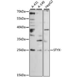 Western Blot - Anti-STYX Antibody (A88909) - Antibodies.com