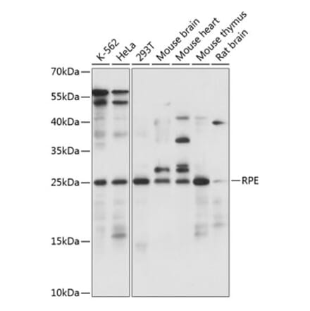 Western Blot - Anti-RPE Antibody (A88910) - Antibodies.com