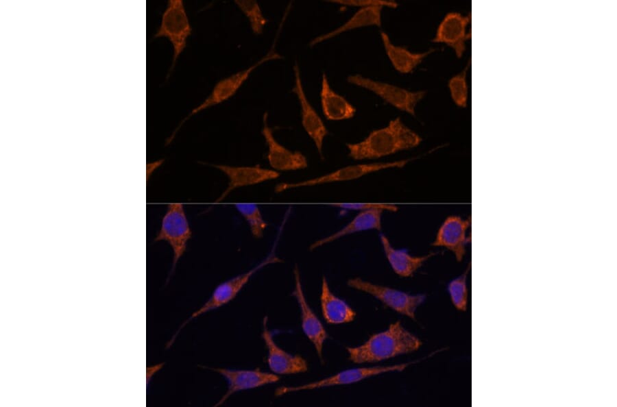 Immunofluorescence - Anti-RPE Antibody (A88910) - Antibodies.com
