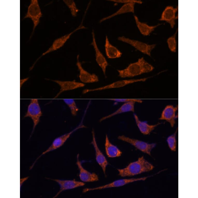 Immunofluorescence - Anti-RPE Antibody (A88910) - Antibodies.com