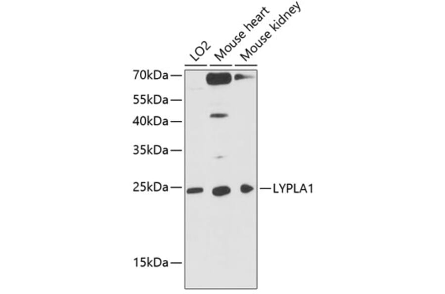 Western Blot - Anti-Lysophospholipase 1/LPL-I Antibody (A88911) - Antibodies.com