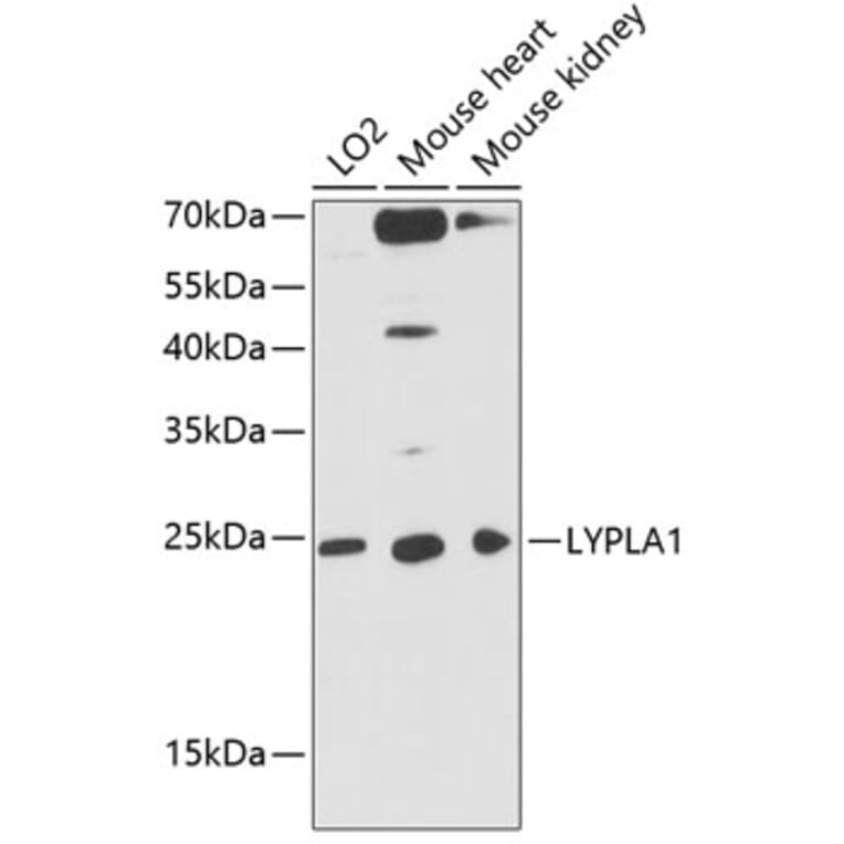 Western Blot - Anti-Lysophospholipase 1/LPL-I Antibody (A88911) - Antibodies.com