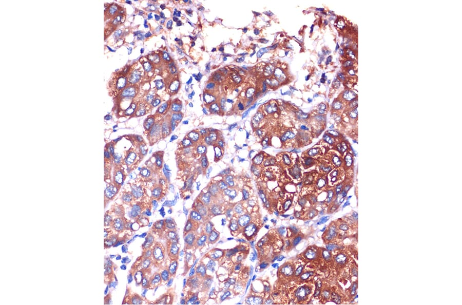 Immunohistochemistry - Anti-Lysophospholipase 1/LPL-I Antibody (A88911) - Antibodies.com