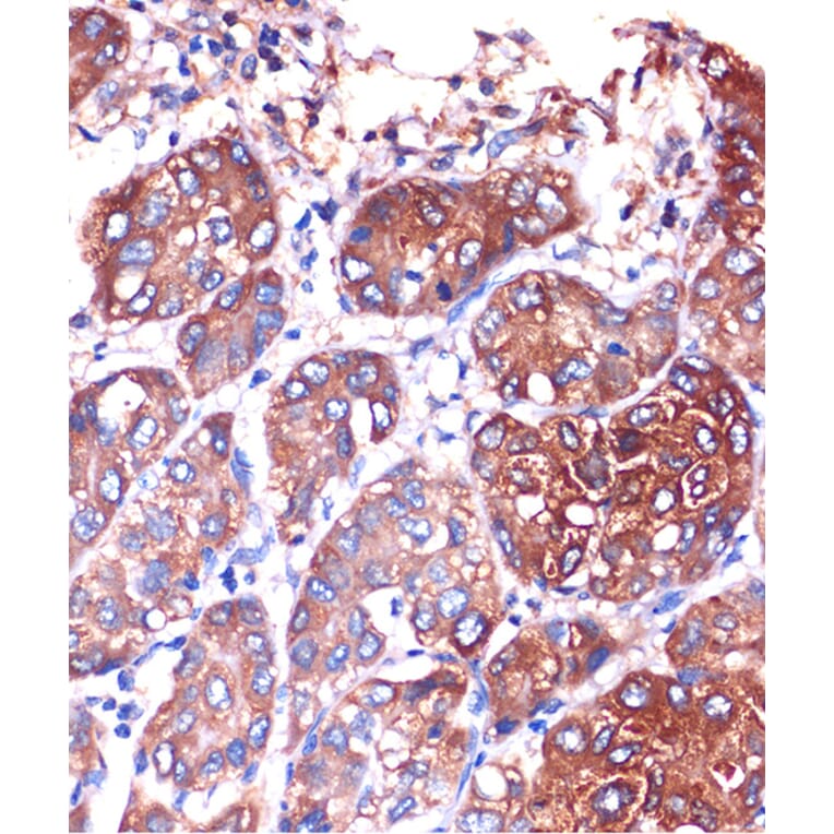 Immunohistochemistry - Anti-Lysophospholipase 1/LPL-I Antibody (A88911) - Antibodies.com