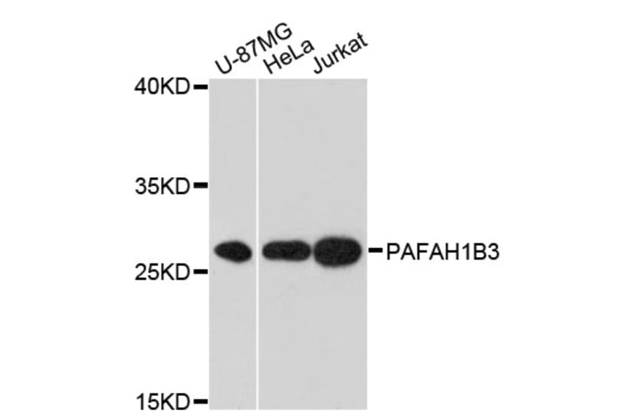 Western Blot - Anti-PAFAH1B3 Antibody (A13037) - Antibodies.com