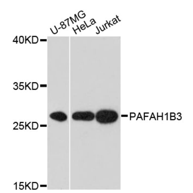 Western Blot - Anti-PAFAH1B3 Antibody (A13037) - Antibodies.com