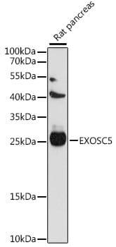 Western blot analysis of extracts of rat pancreas, using Anti-EXOSC5 Antibody (A15870) at 1:1,000 dilution.
Secondary antibody: Goat Anti-Rabbit IgG (H+L) (HRP) (AS014) at 1:10,000 dilution.
Lysates / proteins: 25µg per lane.
Blocking buffer: 3% non-fat dry milk in TBST.
Detection: ECL Basic Kit (RM00020).
Exposure time: 60s.