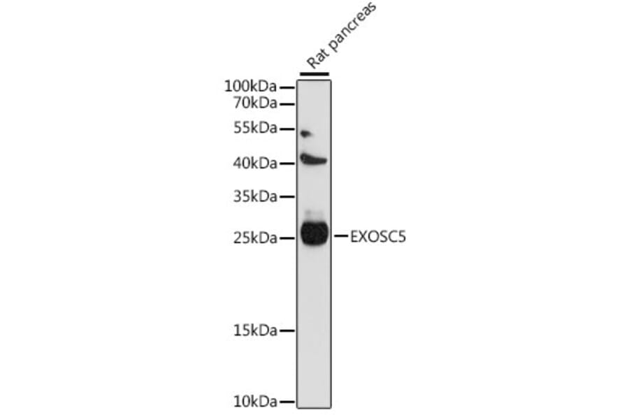 Western Blot - Anti-EXOSC5/CML28 Antibody (A88913) - Antibodies.com