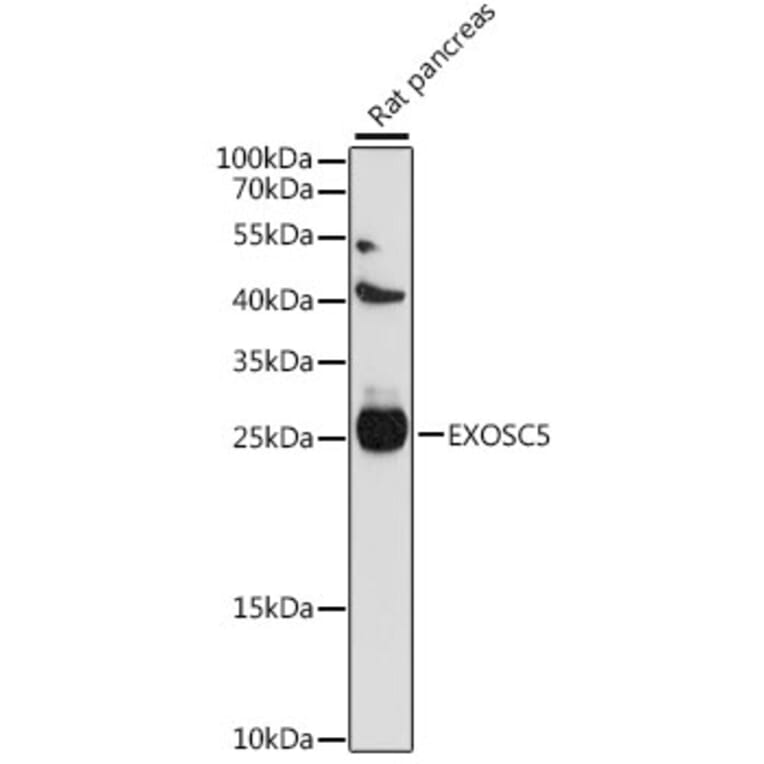 Western Blot - Anti-EXOSC5/CML28 Antibody (A88913) - Antibodies.com