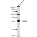 Western Blot - Anti-EXOSC5/CML28 Antibody (A88913) - Antibodies.com