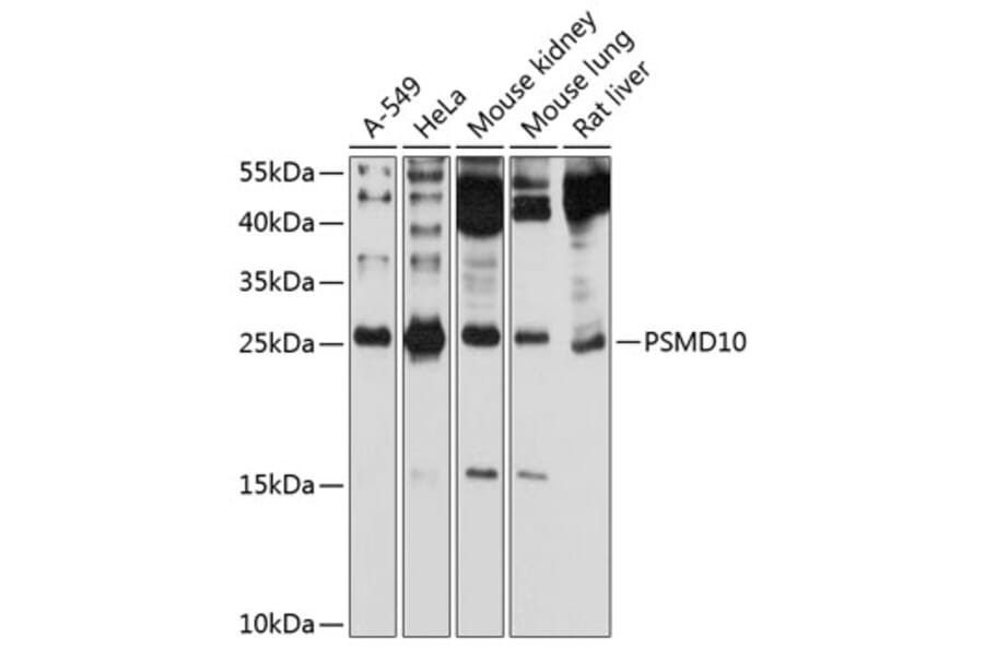 Western Blot - Anti-PSMD10 Antibody (A12469) - Antibodies.com