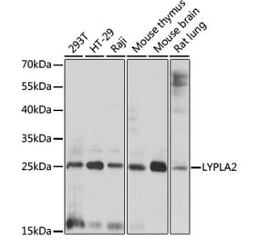Western Blot - Anti-APT-2 Antibody (A88915) - Antibodies.com