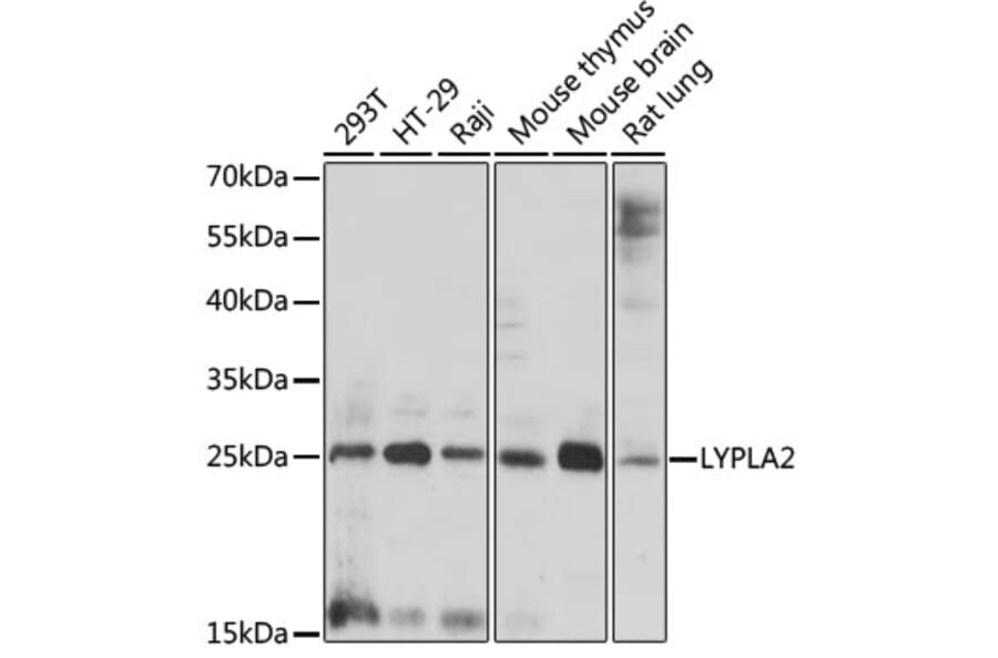 Western Blot - Anti-APT-2 Antibody (A88915) - Antibodies.com