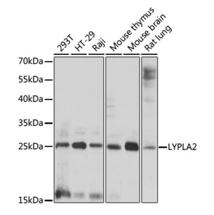 Western Blot - Anti-APT-2 Antibody (A88915) - Antibodies.com