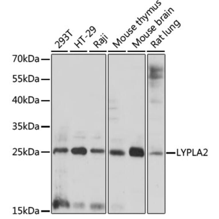 Western Blot - Anti-APT-2 Antibody (A88915) - Antibodies.com