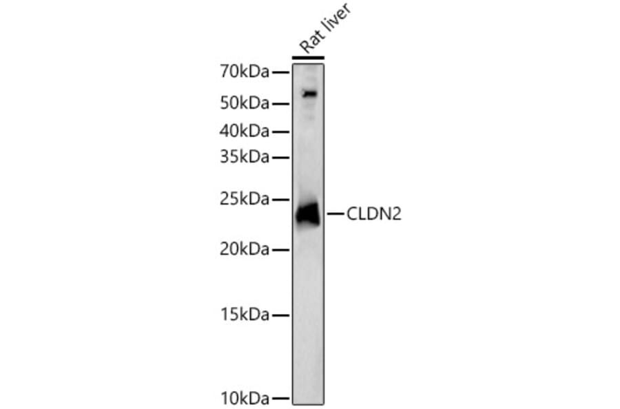 Western Blot - Anti-Claudin 2 Antibody (A88917) - Antibodies.com