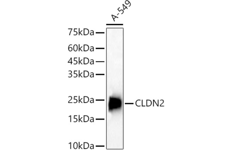 Western Blot - Anti-Claudin 2 Antibody (A88917) - Antibodies.com
