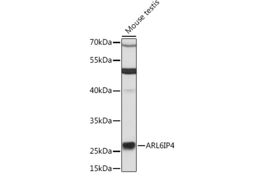 Western Blot - Anti-ARL6IP4 Antibody (A13092) - Antibodies.com