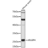 Western Blot - Anti-ARL6IP4 Antibody (A13092) - Antibodies.com