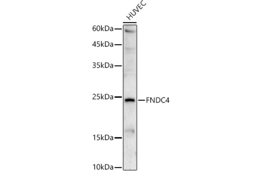 Western Blot - Anti-FNDC4 Antibody (A88919) - Antibodies.com