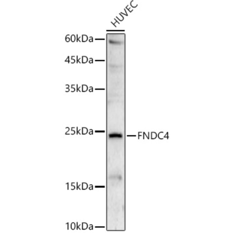 Western Blot - Anti-FNDC4 Antibody (A88919) - Antibodies.com