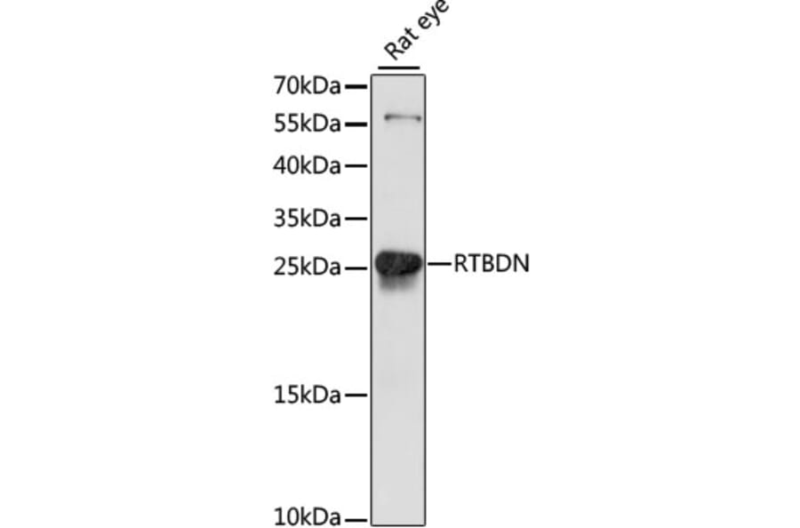 Western Blot - Anti-FLJ36353 Antibody (A88920) - Antibodies.com