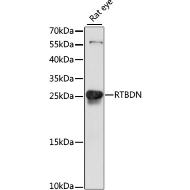 Western Blot - Anti-FLJ36353 Antibody (A88920) - Antibodies.com