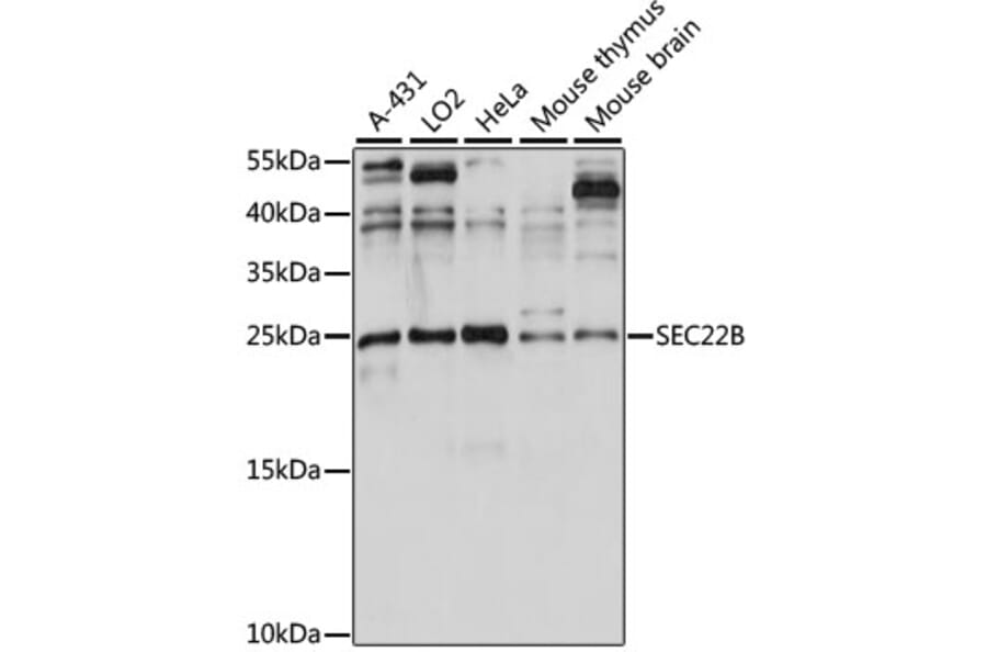 Western Blot - Anti-SEC22B Antibody (A88921) - Antibodies.com