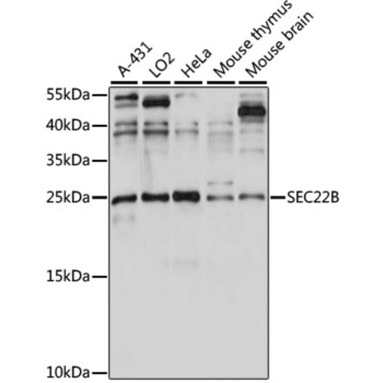 Western Blot - Anti-SEC22B Antibody (A88921) - Antibodies.com