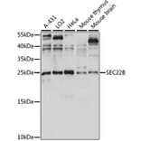 Western Blot - Anti-SEC22B Antibody (A88921) - Antibodies.com