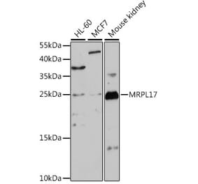 Western Blot - Anti-MRPL17 Antibody (A88922) - Antibodies.com