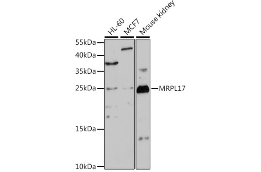 Western Blot - Anti-MRPL17 Antibody (A88922) - Antibodies.com