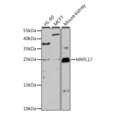 Western Blot - Anti-MRPL17 Antibody (A88922) - Antibodies.com