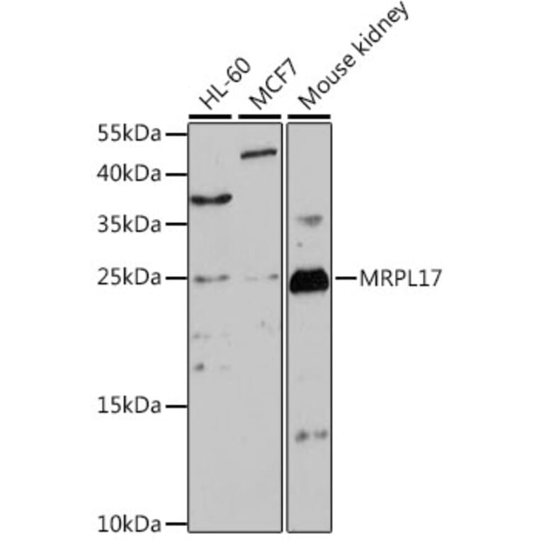 Western Blot - Anti-MRPL17 Antibody (A88922) - Antibodies.com
