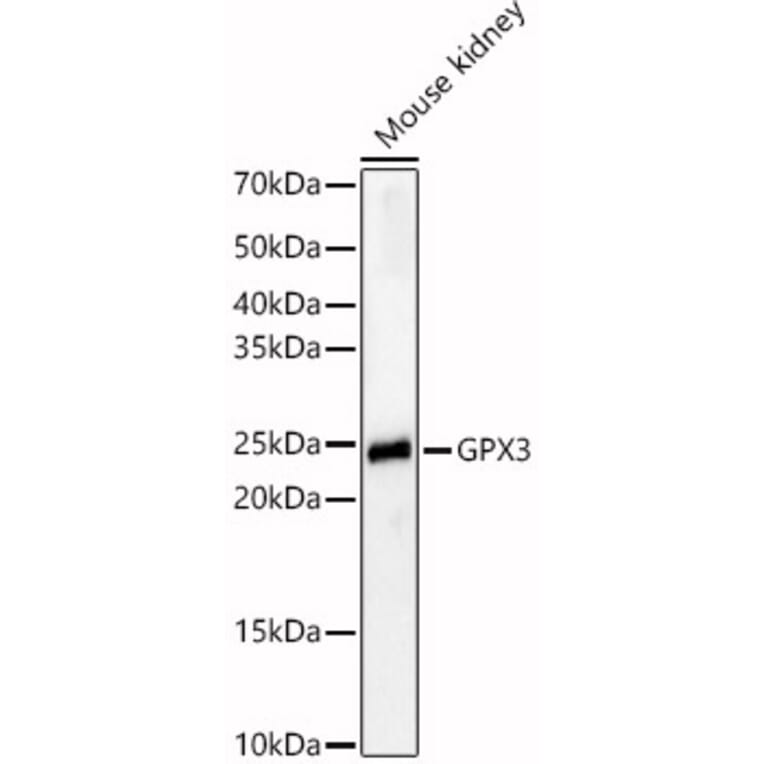 Western Blot - Anti-Glutathione Peroxidase 3/GPx-3 Antibody (A88923) - Antibodies.com