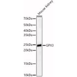 Western Blot - Anti-Glutathione Peroxidase 3/GPx-3 Antibody (A88923) - Antibodies.com