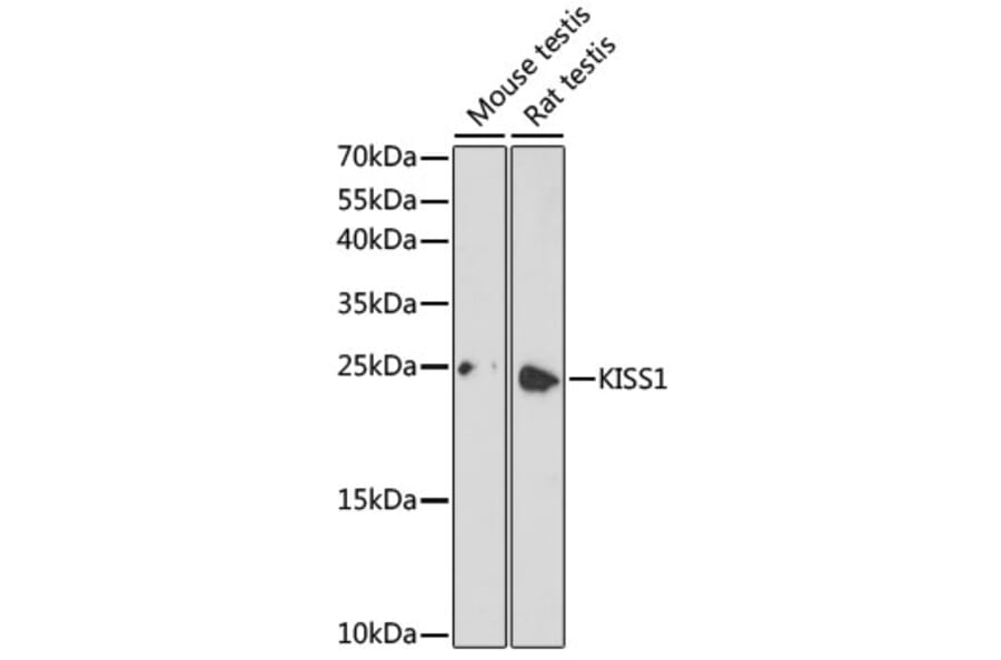 Western Blot - Anti-KISS1 Antibody (A16692) - Antibodies.com