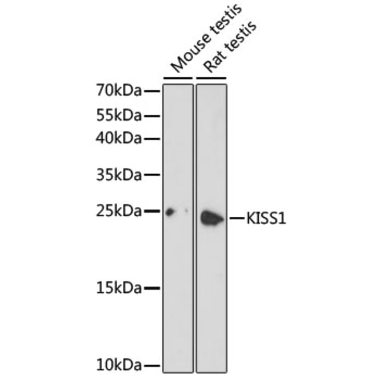 Western Blot - Anti-KISS1 Antibody (A16692) - Antibodies.com