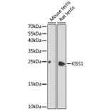 Western Blot - Anti-KISS1 Antibody (A16692) - Antibodies.com
