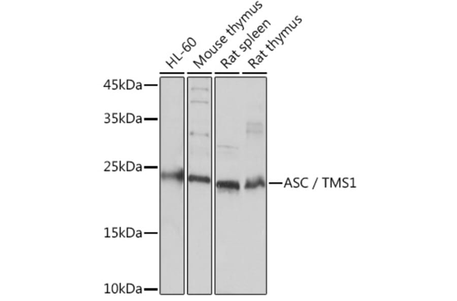 Western Blot - Anti-TMS1/ASC Antibody (A88925) - Antibodies.com