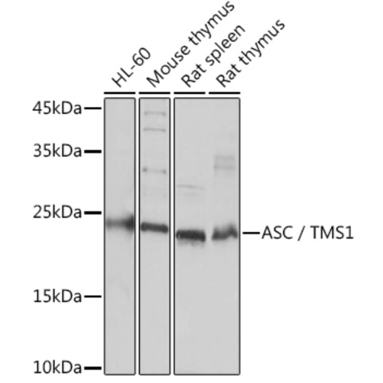 Western Blot - Anti-TMS1/ASC Antibody (A88925) - Antibodies.com