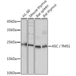 Western Blot - Anti-TMS1/ASC Antibody (A88925) - Antibodies.com