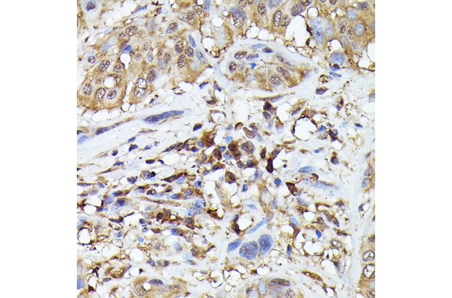 Immunohistochemistry - Anti-TMS1/ASC Antibody (A88925) - Antibodies.com